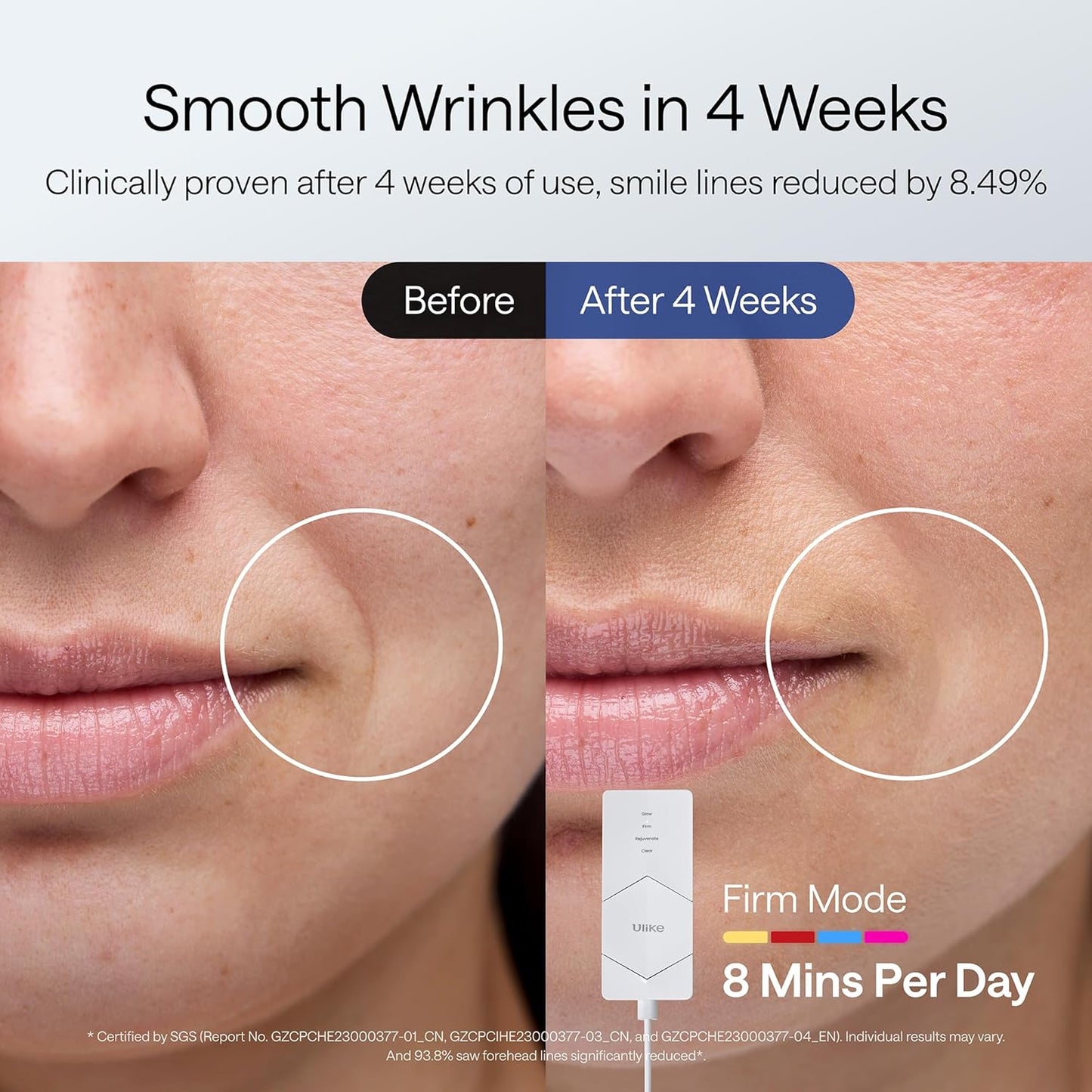 RadiantGlow LED Mask™