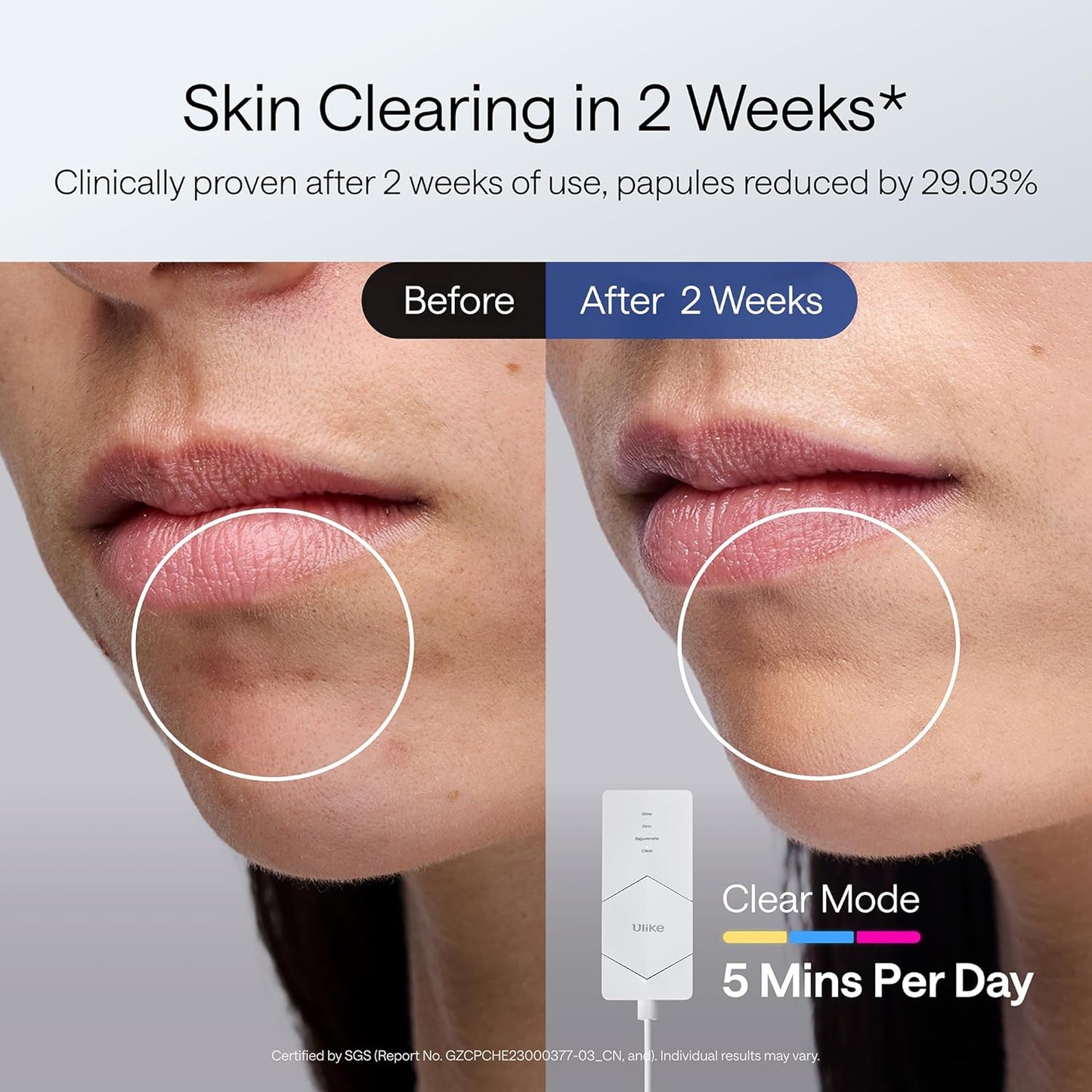 RadiantGlow LED Mask™