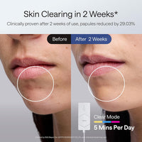 RadiantGlow LED Mask™